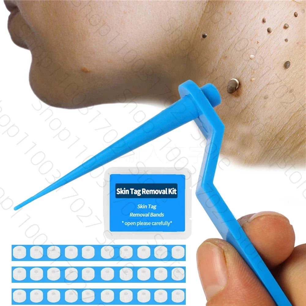 30pcs Skin Tag Remover Rubber Rings - Non-Toxic & Painless Wart Removal