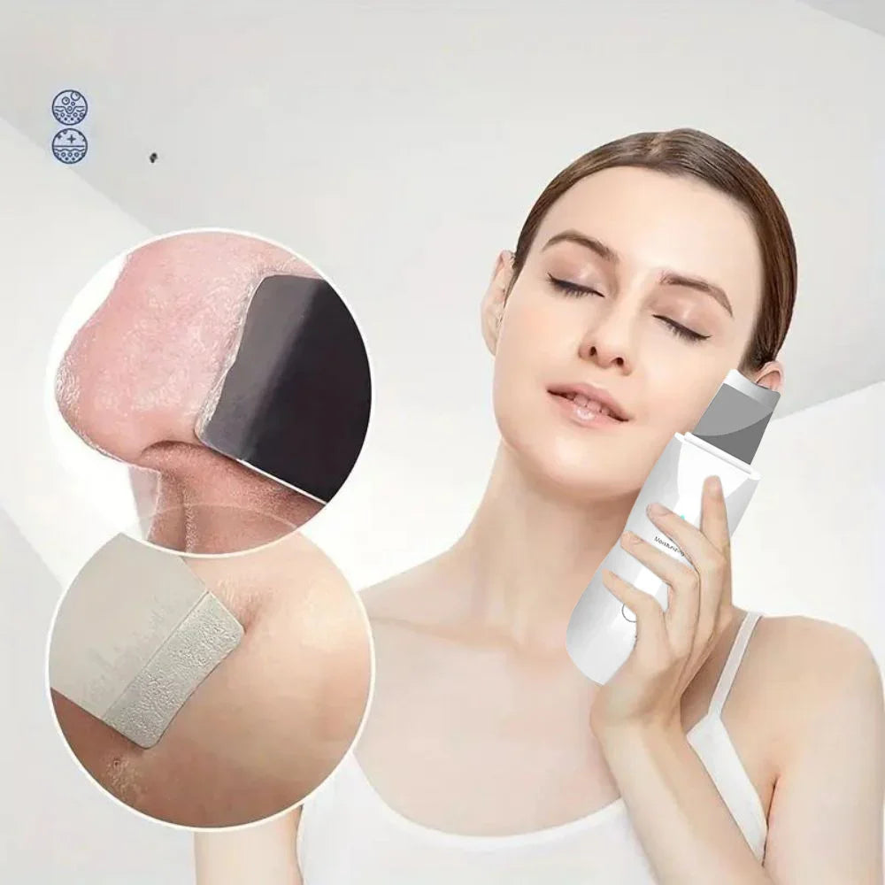 Ultrasonic Skin Scraper - Deep Pore Cleaning Facial Machine for Men & Women