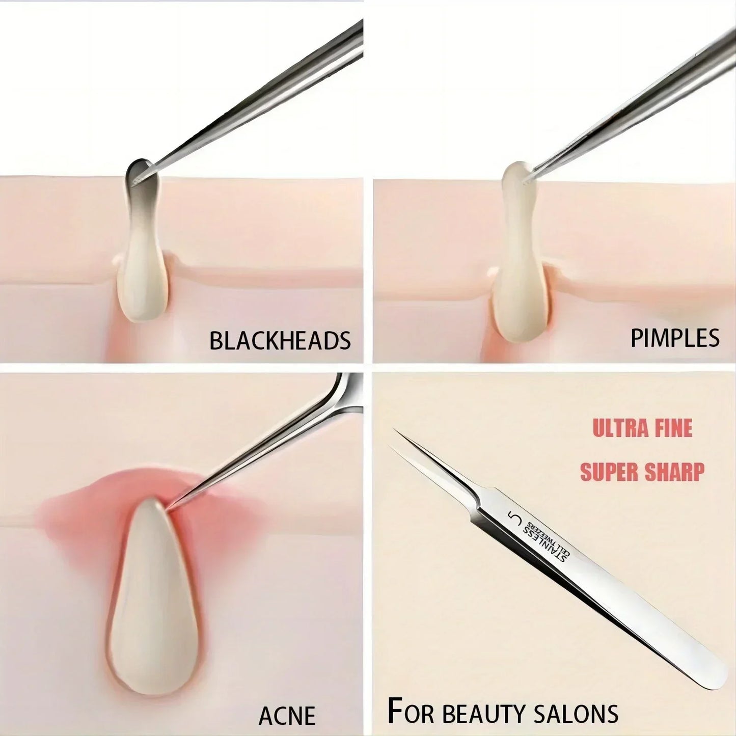 Extra Fine No. 5 Blackhead Tweezers - Precision Acne Removal Tool