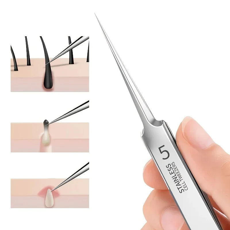 Extra Fine No. 5 Blackhead Tweezers - Precision Acne Removal Tool