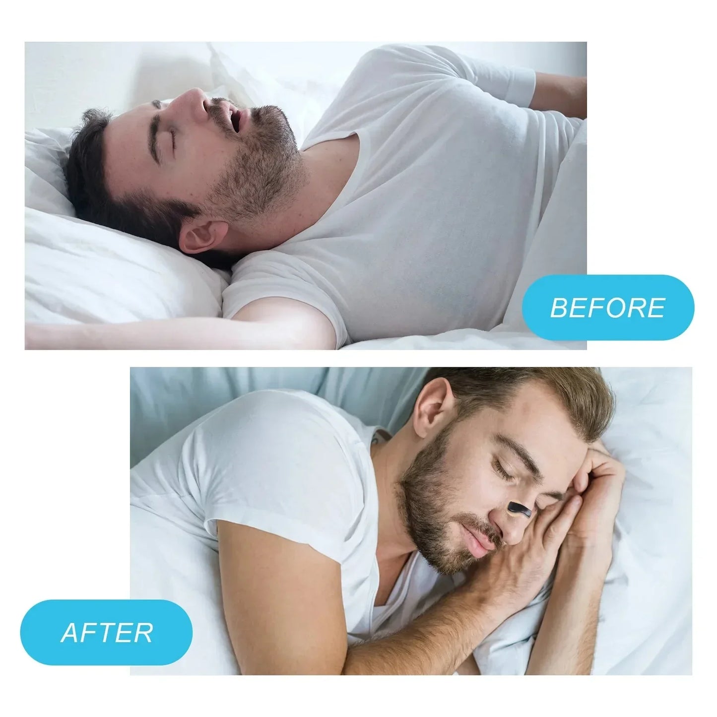MINISO Magnetic Nasal Dilator Anti-Snoring Device – Enhance Breathing & Sleep