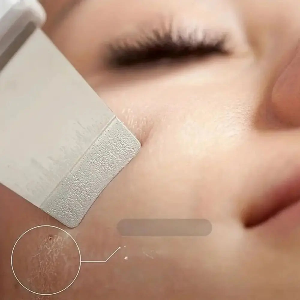 Ultrasonic Skin Scraper - Deep Pore Cleaning Facial Machine for Men & Women