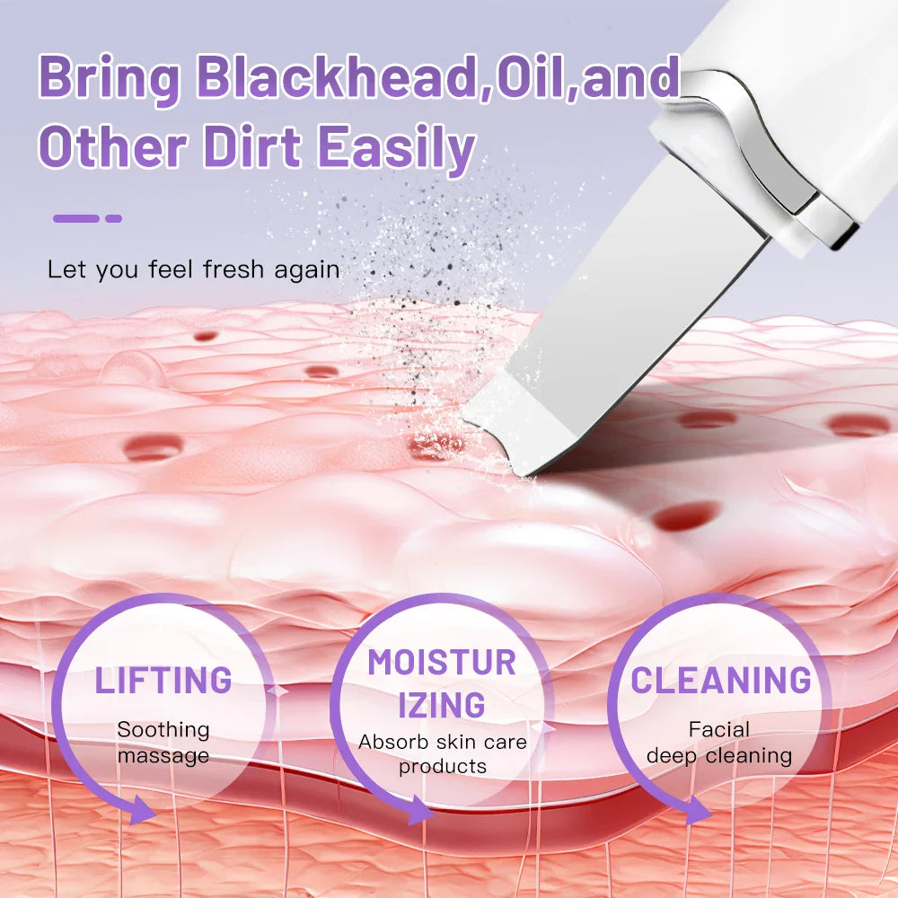Electric Ultrasonic Skin Scrubber - Blackhead Remover & Facial Lifting Tool