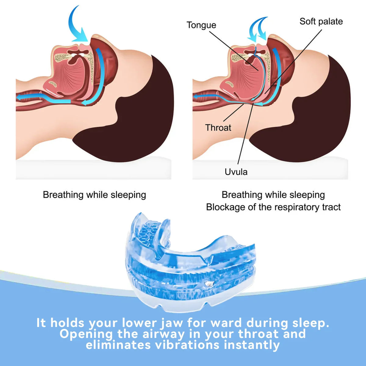 Anti Snore Bruxism Mouth Guard | Stop Snoring & Sleep Aid