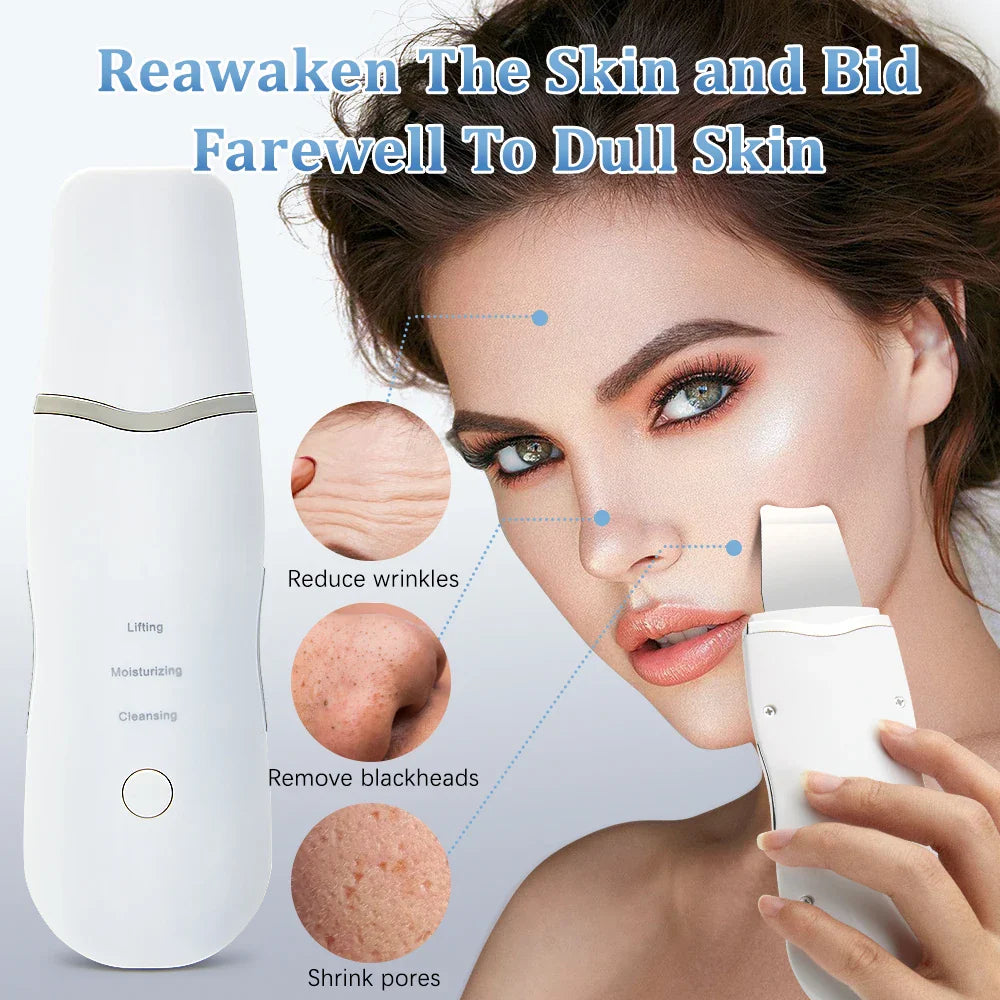 Electric Ultrasonic Skin Scrubber - Blackhead Remover & Facial Lifting Tool
