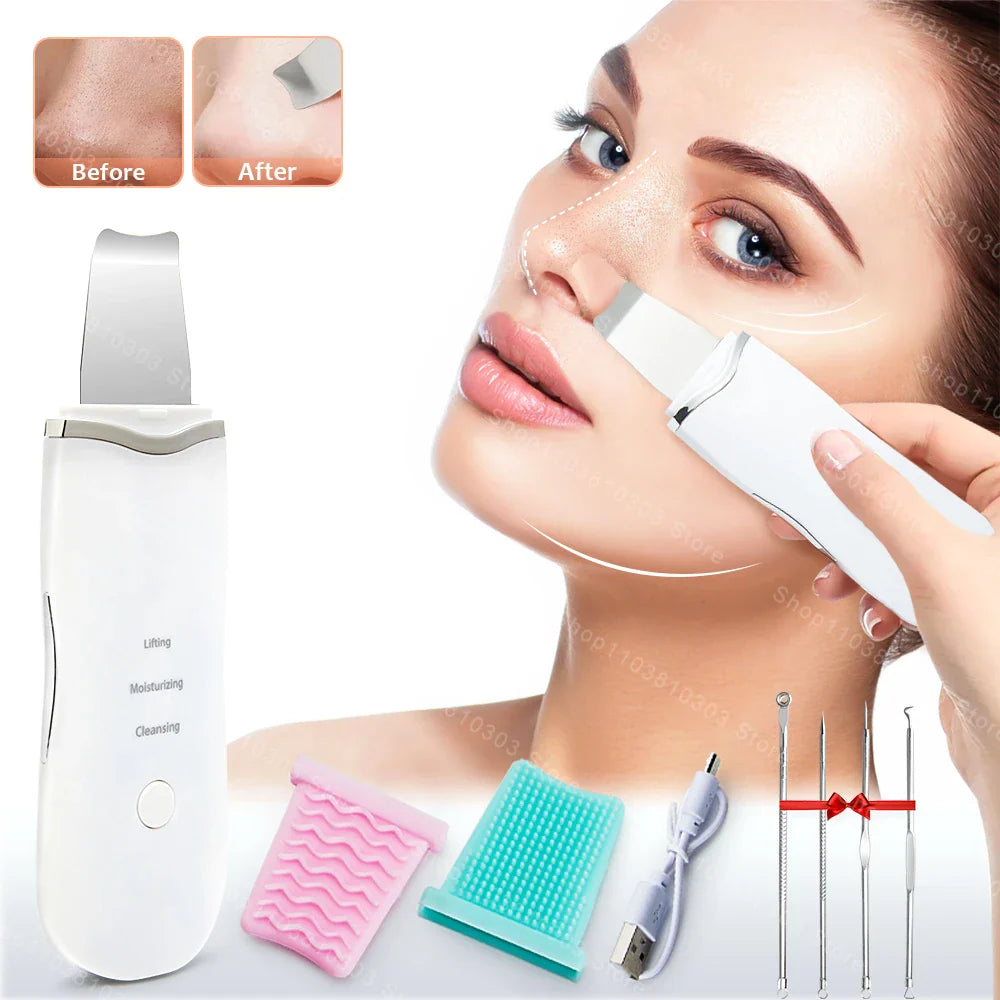 Electric Ultrasonic Skin Scrubber - Blackhead Remover & Facial Lifting Tool