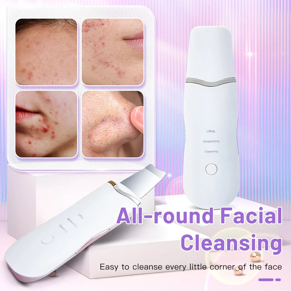 Electric Ultrasonic Skin Scrubber - Blackhead Remover & Facial Lifting Tool